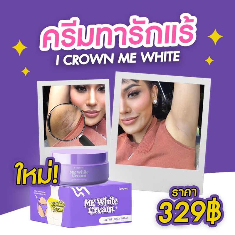 พร้อมส่ง-ครีมทาง่ามขา-ครีมง่ามขา-แม่แอนนา-โลชั่นโมอมีนา-สบู่ฟอกง่าม-ครีมทาง่ามขาดำ-mewhite-cream