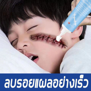 ของ​แท้​100​% นำเข้า​จาก​ ครีมลดรอยแผลเป็น ซ่อมแซมรอยแผลเป็นจากการผ่าตัด เจลลบรอยแผลเป็น