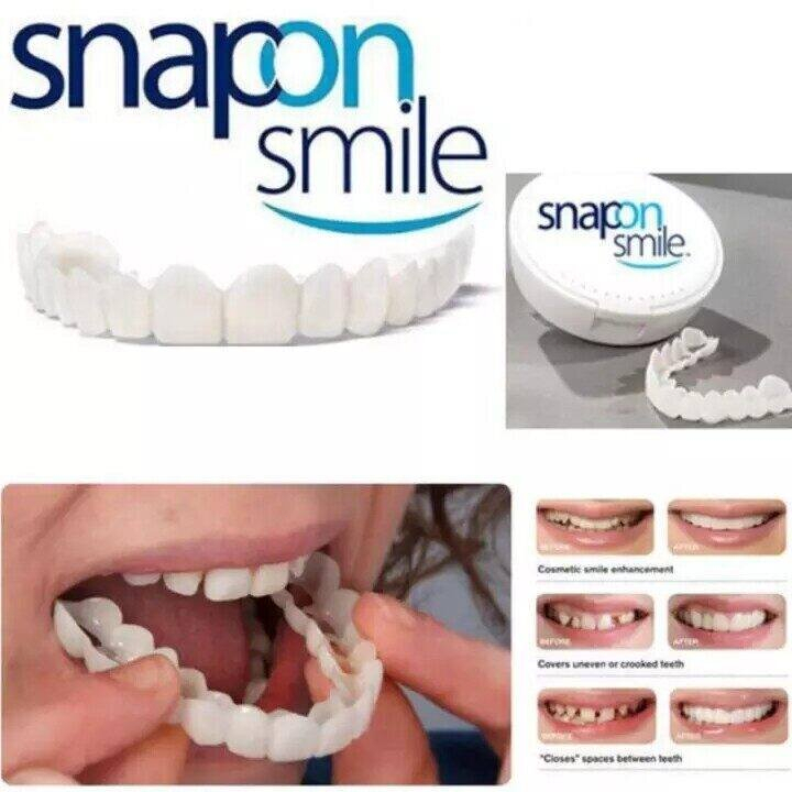ฟันปลอม-ซิลิโคนของเล่น-ฟันปลอมทันตกรรมวีเนียร์ฟัน-ฟันปลอมของแท้-dentadura-postiza-completaจัดฟันขาวจัดฟัน-ฟันปลอมแบบครอบ