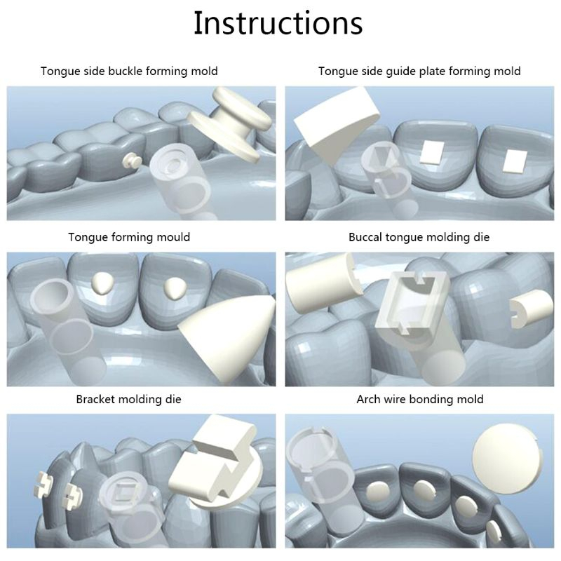 โมลเดลขึ้นโครงรูปร่างทางทันตกรรมจัดฟัน-orthodontic-mould-kit