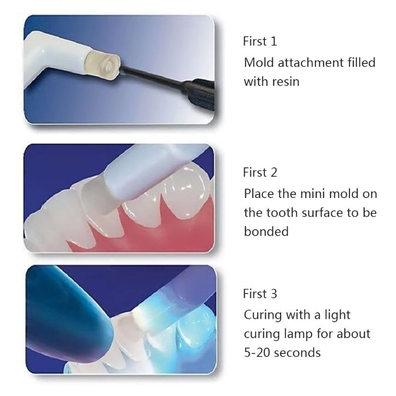 โมลเดลขึ้นโครงรูปร่างทางทันตกรรมจัดฟัน-orthodontic-mould-kit