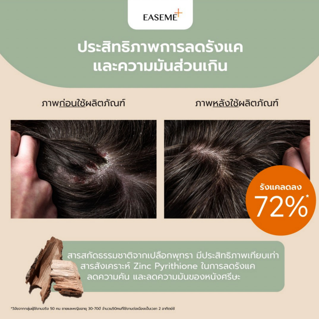 2ขวดราคาพิเศษ-แชมพู-2in1-สูตรเข้มข้น-หยุดทุกปัญหาผมในขั้นตอนเดียว