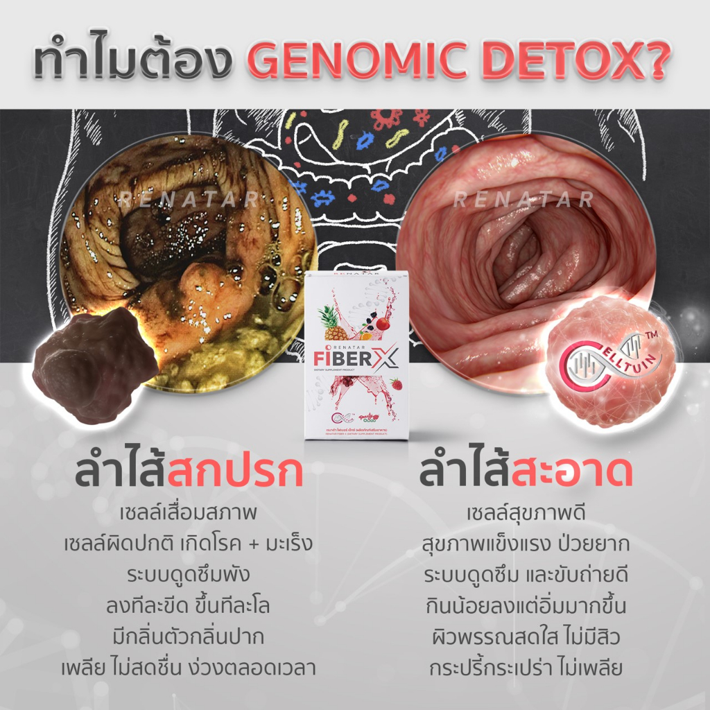 fiber-x-เรนาต้าไฟเบอร์เอ็ก-ดีท็อกซ์ลำไส้จากธรรมชาติ