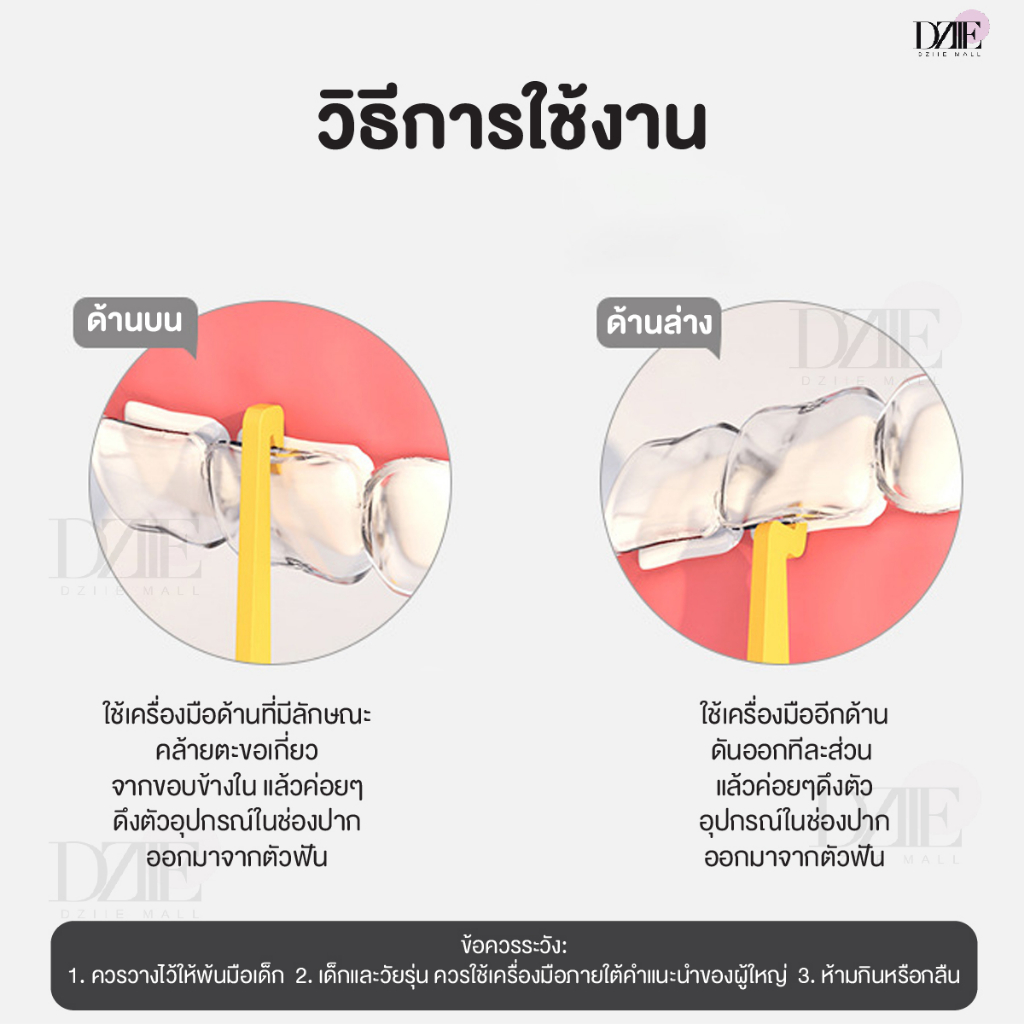 y-kelin-aligner-remover-เครื่องมือถอดอุปกรณ์จัดฟัน-สายฟ้า-หยดน้ำ-จัดฟันใส-ที่เกี่ยวอุปกรณ์จัดฟัน-จัดฟันแบบใส-1ชิ้น