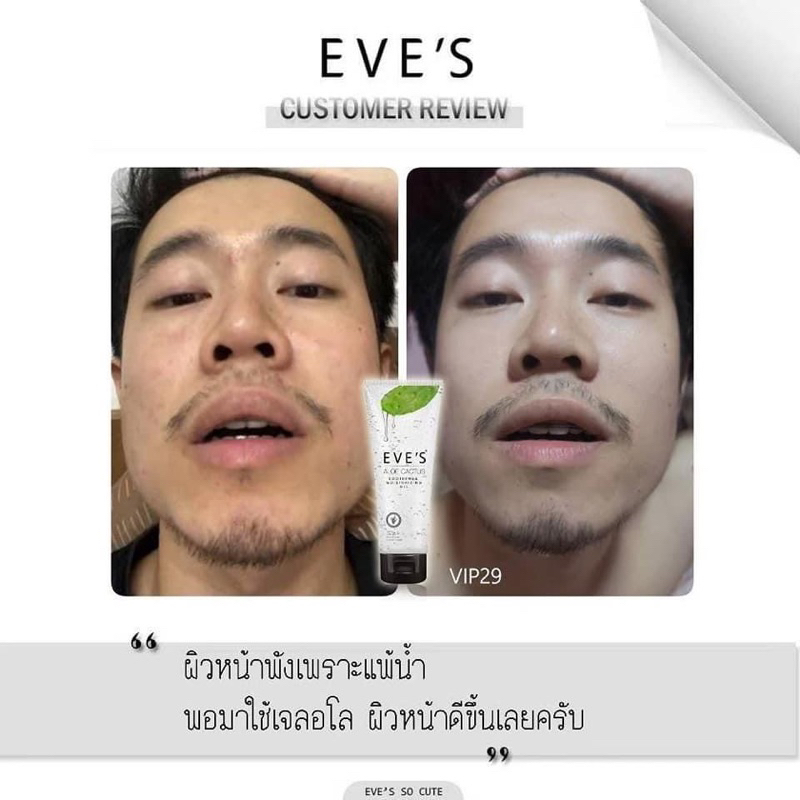 eves-set-ลดสิว-ผิวชุ่มชื้น-ลดการอักเสบ-บวมแดงของสิว