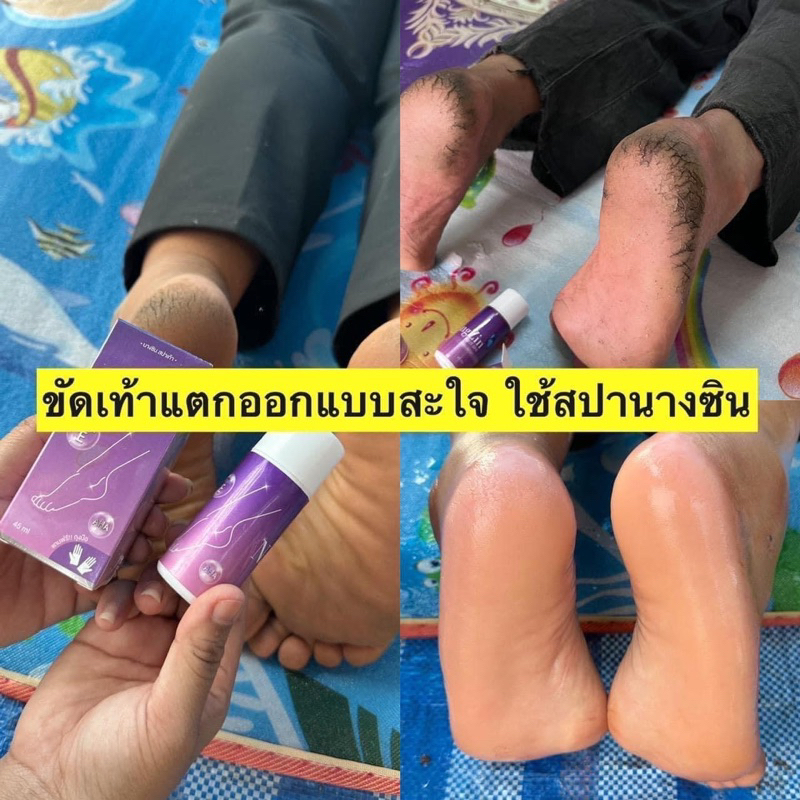 2ทุ่มไลฟ์สดลด-50-สปาเท้านางซิน-ไลฟ์สดลด-50-nangzin-foot-spa-สปาเท้านางซิน-ผิวเท้าเรียบเนียน-นางซินสปาเท้า