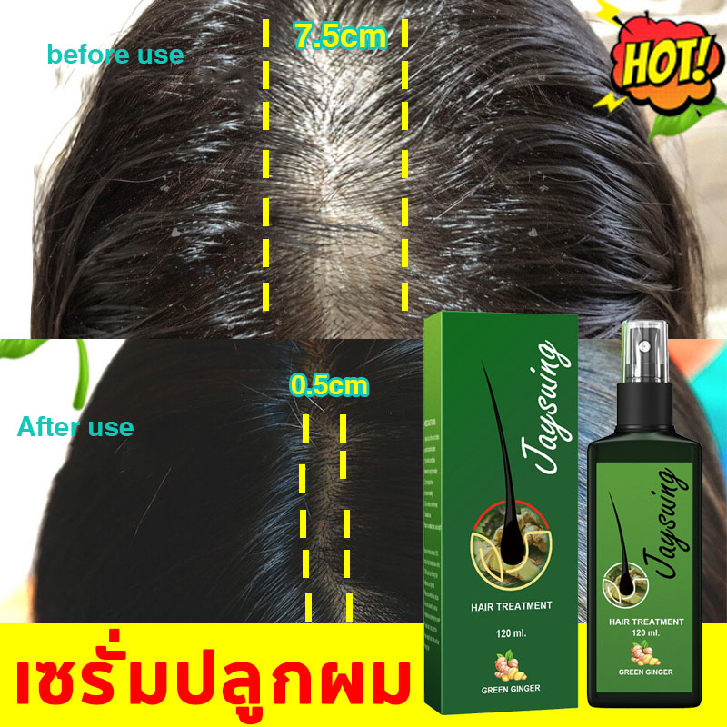 ยาปลูกผมของแท้-เซรั่มปลูกผม-120ml-ป้องกันผมร่วง-บำรุงผม-และบำรุงรากผม-สเปรย์ปลูกผม-น้ำยาปลูกผม-ลดผมร่วง-น้ำยาเร่งผมยาว