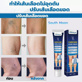 ของแท้100-ครีมสมุนไพรรักษาเส้นเลือดขอด-1หลอด20กรัม-ครีมเส้นเลือดขอด-รักษาเส้นเลือดขอด