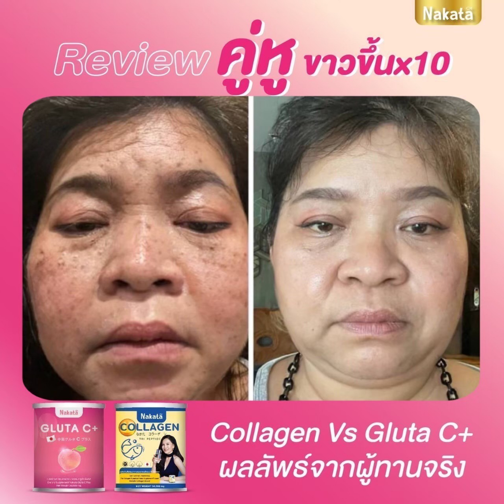 1-แถม-1-ส่งฟรี-คอลลาเจน-กลูต้า-สูตรบำรุงผิวขาวเร่งด่วน-คอลาเจน-ผิวพรรณเปร่งปลั่ง-สดใส