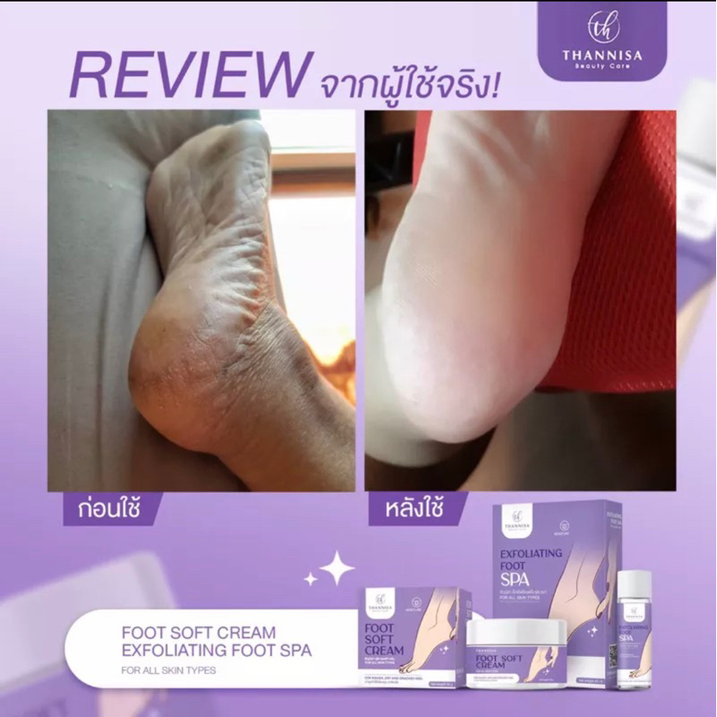 พร้อมส่ง-ส่งฟรี-thannisa-spa-foot-สปาเท้าธัญนิสา-โทนเนอร์-ครีมทารักแร้-ตาตุ้มเก-รักแร้ดำ-เห็นผลตั้งแต่ครั้งแรกที่ใช้