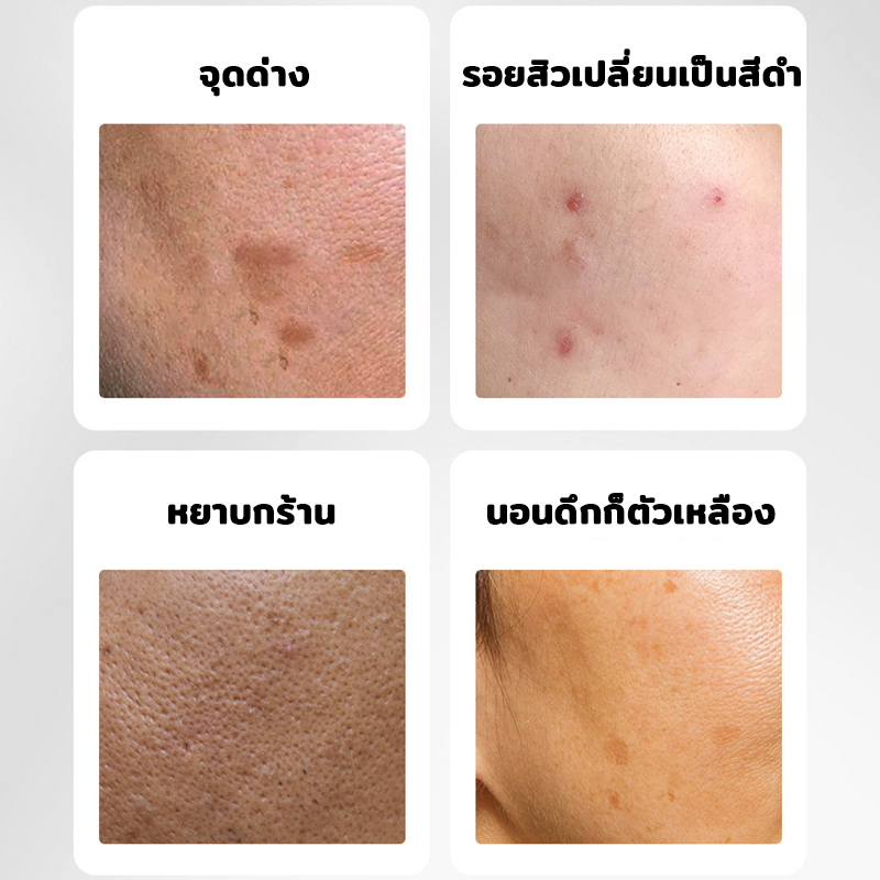 เซรั่มบำรุงผิวหน้า-เซรั่มหน้าขาวใส-35ml-จุดด่างดำจางเร็ว-หน้าขาวใส-ลดริ้วรอย-กระชับรูขุมขน-ครีมทาฝ้ากระ-ครีมแต้ม