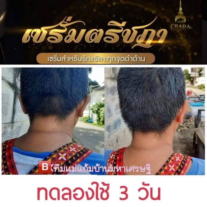 โปรสุดคุ้ม-3-ซอง-เซรั่ม-ตรีชฎา-คุ้มกลิ่นคุ้มเหงื่อ-24-ชั่วโมง