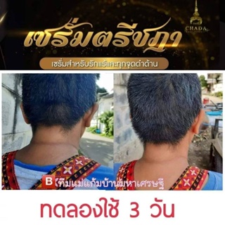 (โปรสุดคุ้ม 3 ซอง) เซรั่ม ตรีชฎา คุ้มกลิ่นคุ้มเหงื่อ 24 ชั่วโมง