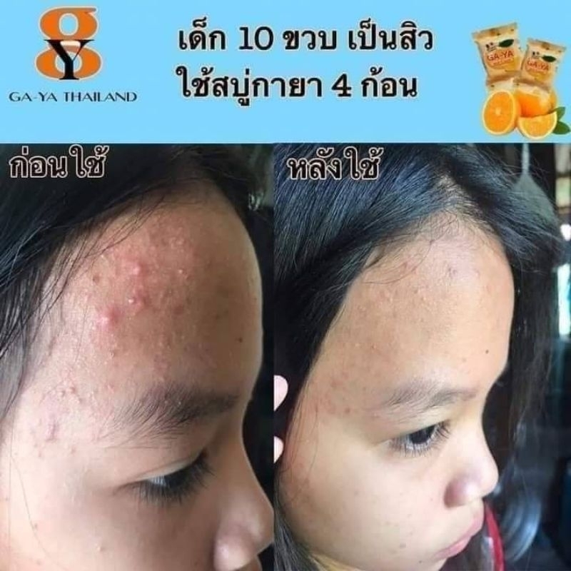 โปรตัวแทน-20-ก้อน-สบู่กายาที่คุณพลอยชิดจันทร์ขาย