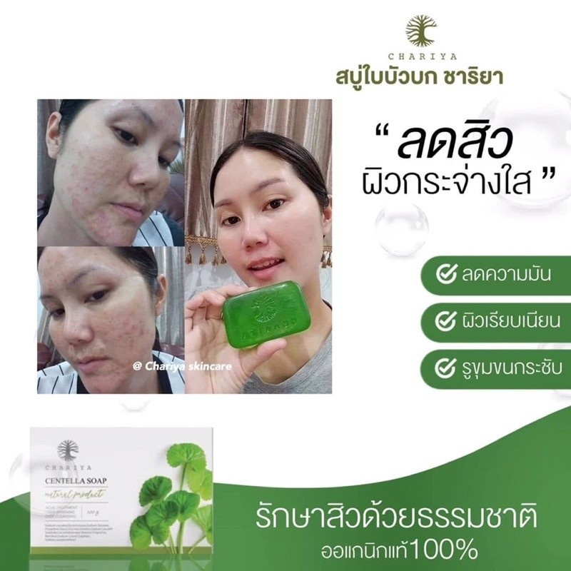 ชาริยา-chariya-ลดสิว-ผิวแพ้ง่าย-สบู่ใบบัวบก-ลดสิวอักเสบ-ผิวติดสาร-มาส์กสมุนไพร-เจลว่านชาริยา-ฟื้นฟูผิว-ผิวแข็งแรง