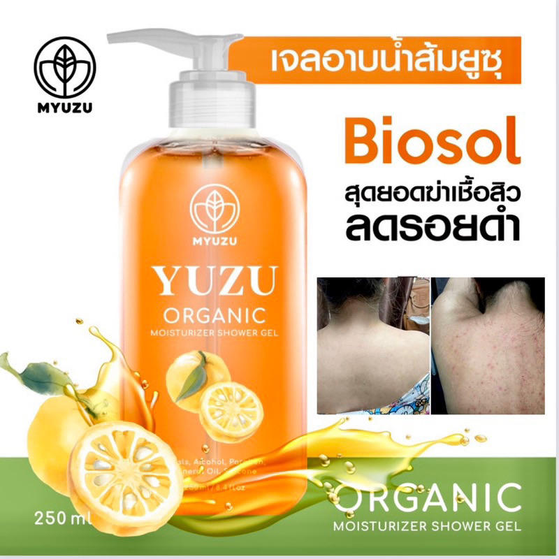 เซ็ตสุดคุ้มx3ขวด-เจลอาบน้ำมิวซุ-organic-มี-biosol-ช่วยฆ่าเชื้อสิว-ลดรอยดำ-ผดผื่น-สิวหลัง-สิวหน้าอก-ลดสิวที่หลัง