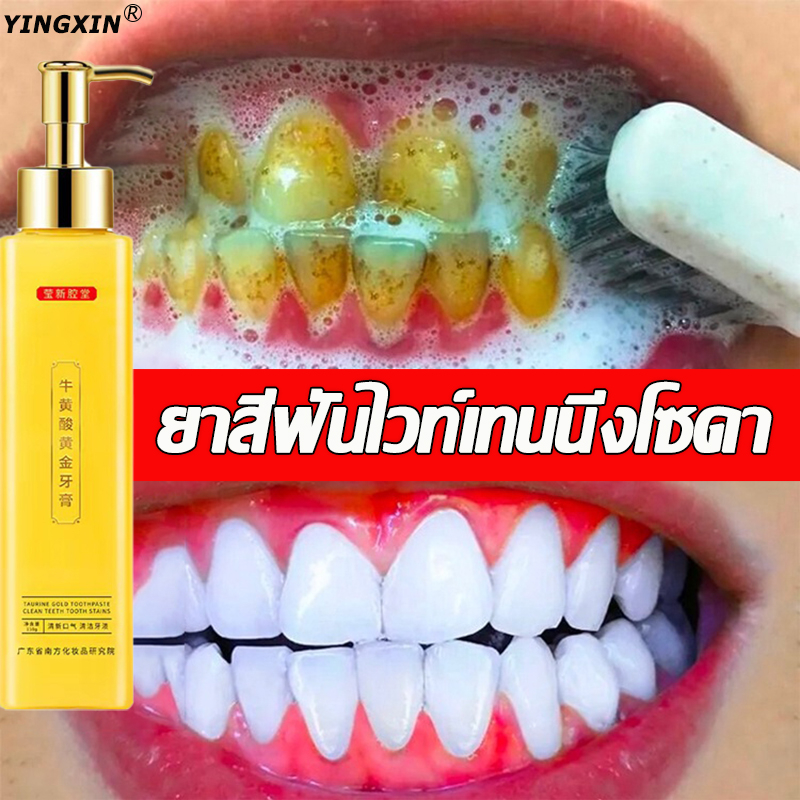 พร้อมส่ง-ยาสีฟันฟันขาว-205g-ฟอกฟันขาว-ฟันขาว-ยาสีฟันฟอกขาว-ยาสีฟันขาว-ฟอกสีฟันขาว-ยาสีฟันฟอกฟันขาว-ยาฟอกสีฟันขาว