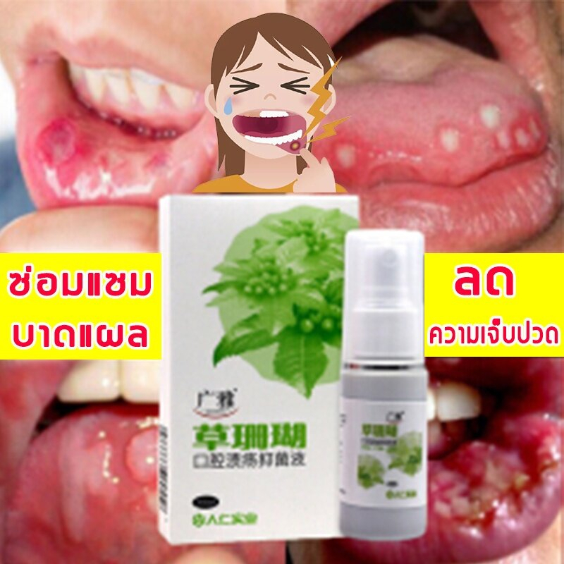 ครีมทาแผลในปาก-แผลร้อนใน-ครีมต้านแบคทีเรีย-เพื่อสุขภาพช่องปากที่แข็งแรง-ลดปัญหาในช่องปากให้ความรู้สึกถึงความสะอาด-ยาสีฟั