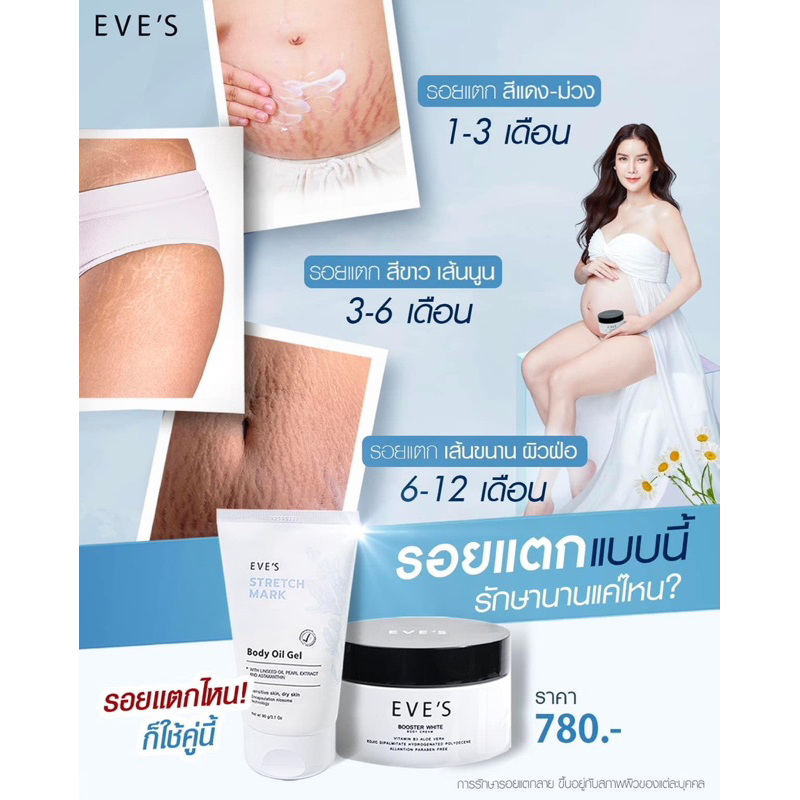 eves-ของแท้-บูสเตอร์อีฟส์-อีฟส์ออยล์-ครีมลดรอยแตกลาย-ครีมป้องกันท้องแตกลาย-ครีมคนท้อง-ครีมทาท้อง