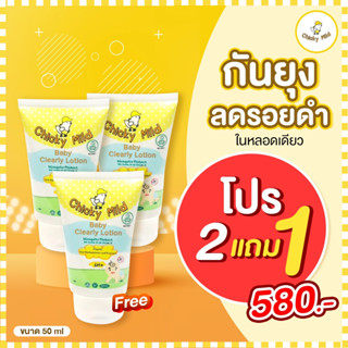 ✅ โปร 2 แถม 1 โลชั่นกันยุง Chicky Mild 50ml สูตรลดรอยดำ บำรุงผิว ลดรอยขาลาย .ให้จางลง กลิ่นละมุน ไม่ฉุน