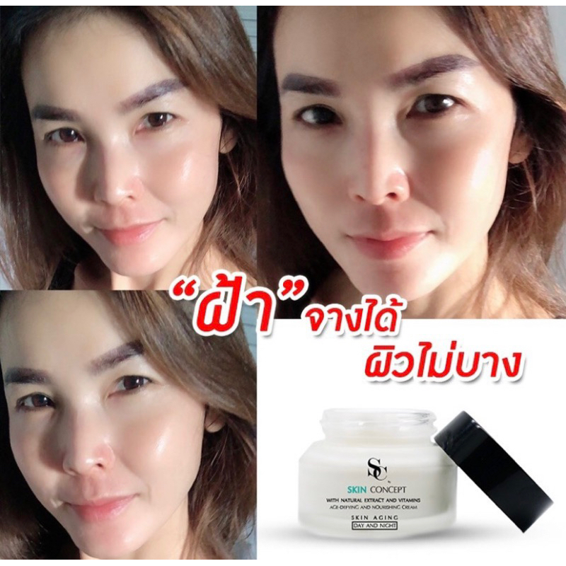 เซ็ท-3-ชิ้น-เอสซีครีม-ครีมทาฝ้ากระ-sc-by-skin-concept-หน้าใส-ลดริ้วรอยก่อนวัย