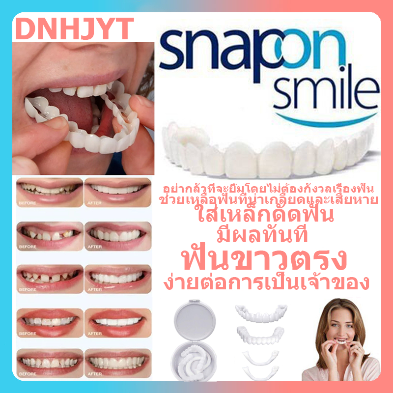 ฟันปลอมซิลิโคนเคี้ยวได้-ฟันปลอมของแท-tooth-ฟันปลอม-ฟันปลอมถอดได้-ฟันปลอมฟันปลอม-ฟันปลอมซี่หน้า-ฟันปลอม-ฟันปลอมเริม