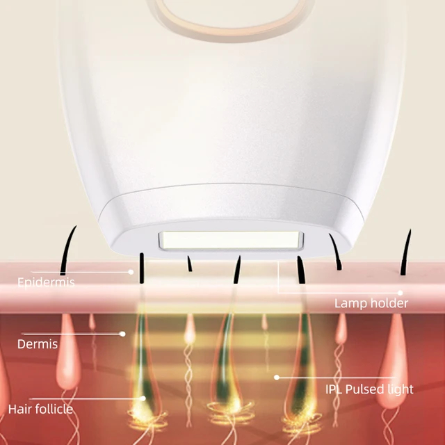 ipl-laser-หน้าใส-กำจัดขน-500-000-shot-ใช้เวลาแค่-10-นาทีต่อวัน-ประกัน-6-เดือน-มี-3-สีให้เลือก