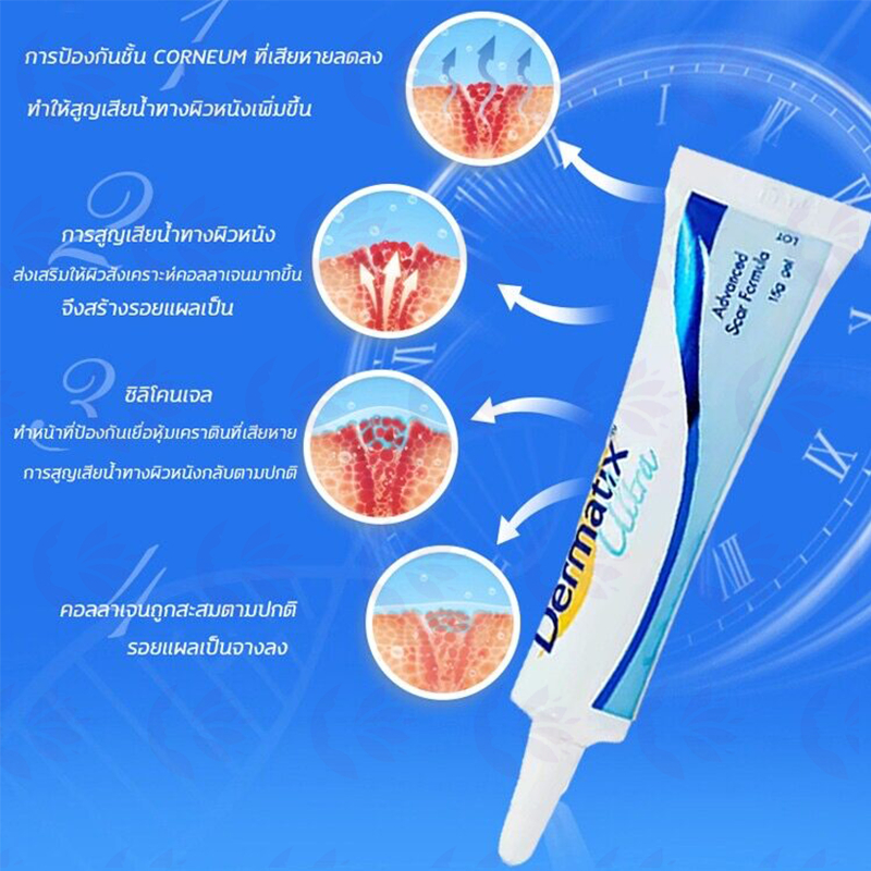 dermatix-ultra-gel-15g-เดอร์มาติกซ์-อัลตร้า-เจล-ครีมลดรอยแผลเป็น-ครีมรักษาแผลเป็น-ครีมลบรอยแผลเป็น-ครีมทาแผลเป็น-รักษารอ