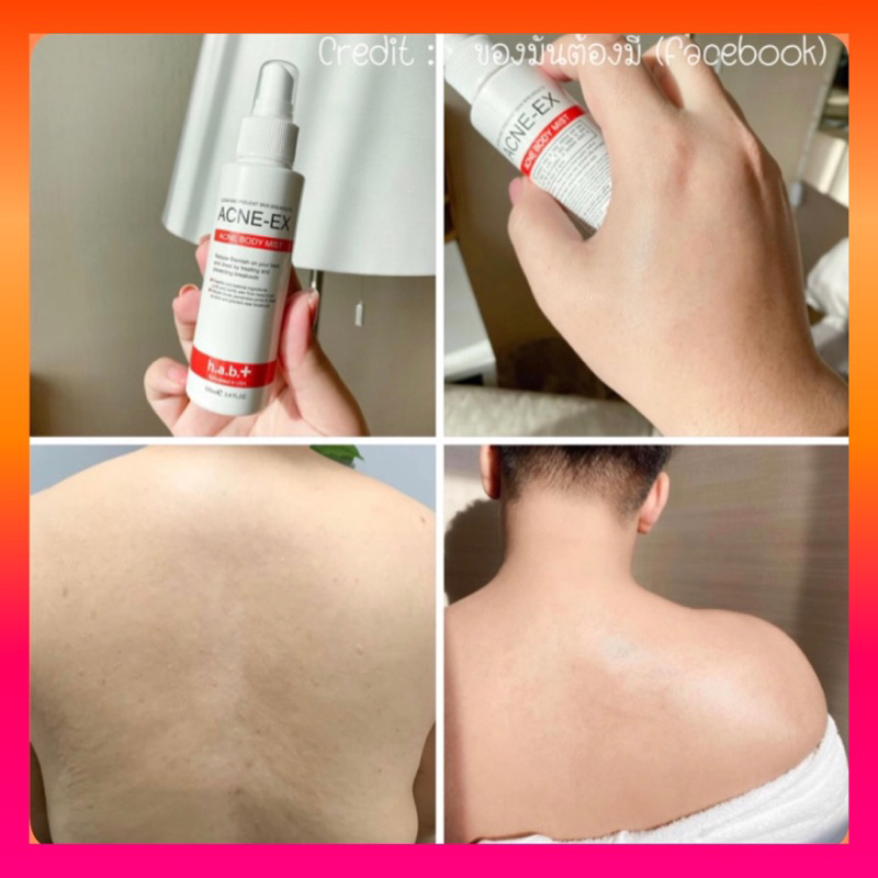 สเปรย์ฉีดสิว-ใช้ดี-รีวิวเพียบ-ของเเท้-acne-ex-body-spray-120-ml-mk008-acne-ex