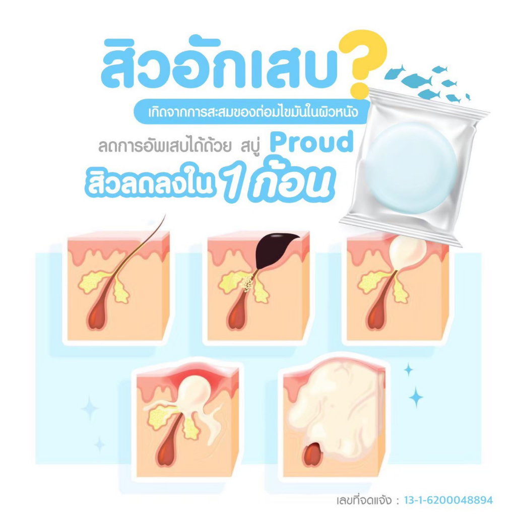 สบู่ลอกฝ้า-สลายฝ้ากระ-สบู่โบท็อกหน้าตึง-หน้าเด้ง-หน้าเด็ก-ปราบฝ้า-ฆร่าสิว-ไม่มีกล่อง