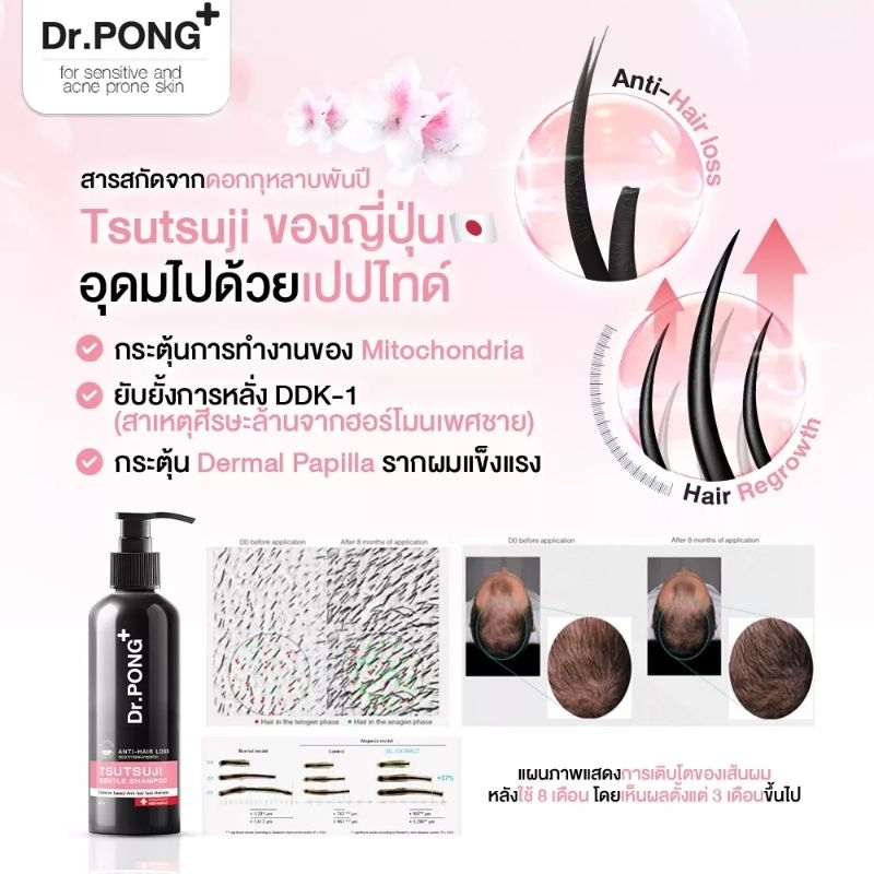 dr-pong-anti-hair-loss-exp-04-25แชมพูลดผมร่วง