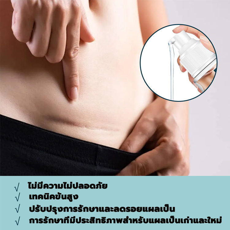 eelhoe-ครีมลดรอยแผลเป็น-50ml-ลบรอยสิว-รอยแผลเป็น-จุดด่างดำ-หมองคล้ำ-ลดผิวแตกลาย-ลบรอยแผลเป็น-scar-gel