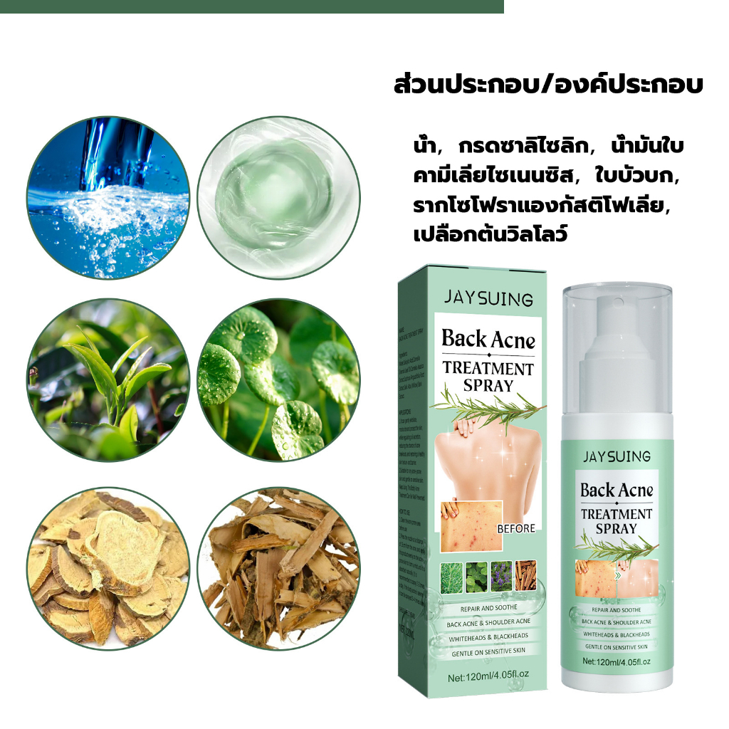 jaysuing-120ml-สิวที่หลัง-แอคเน่-สเปรย์ฉีดแผ่นหลังและลำตัว-ลดไรและสิวตามร่างกาย-กำจัดสิวที่หลังและลำตัว-ครีมแต้มสิว