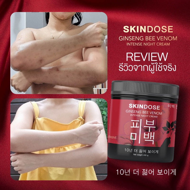 ครีมโสมพิษผึ่ง-skindose-400-g