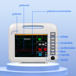 Patient Monitor ECGตรวจสอบทางการแพทย์ที่บ้านอัตราการหายใจออกซิเจนในเลือดตลอด24 ชั่วโมงอัตราการเต้นของหัวใจ เครื่องตรวจคล