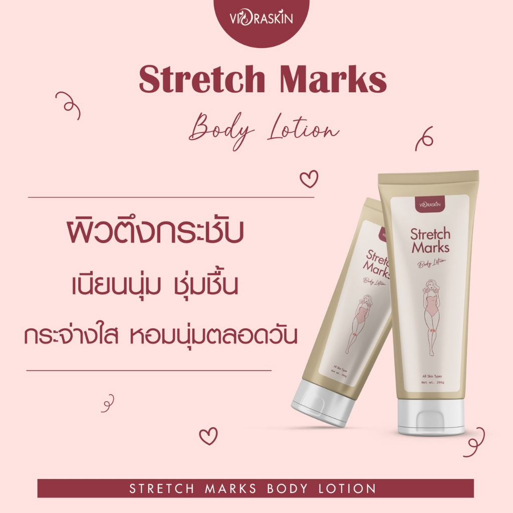 stretch-marks-body-lotion