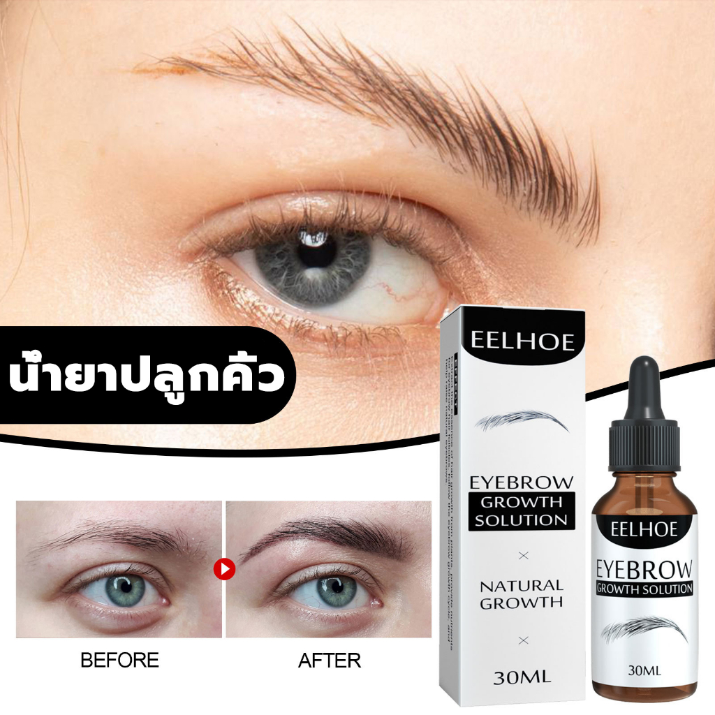 eelhoe-เซรั่ม-ปลูก-คิ้ว-น้ำยาปลูกหนวด-คิ้วดก-หนวดดก-คิ้วเข้ม-30ml-เซรั่มคิ้วดก-เซรั่มปลูกคิ้ว-ยาปลูกคิ้ว-น้ํายาปลูกคิ้ว