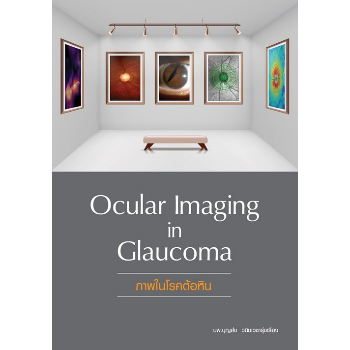 c111-ภาพในโรคต้อหิน-ocular-imaging-in-glaucoma-9786165889223