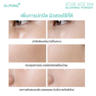 ภาพขนาดย่อของภาพหน้าปกสินค้าDr.PONG ACNE ACE 002 แป้งผสมรองพื้น สูตรลดสิว - ZincPCA - Niacinamide - Tranexamic acid - Tea Tree oil จากร้าน drpongshop บน Shopee ภาพที่ 7