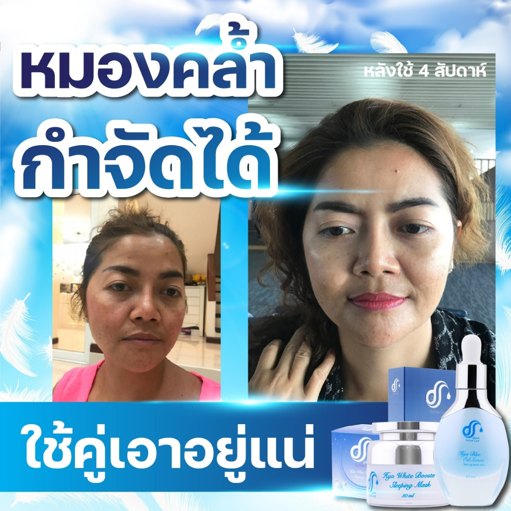 เซรั่ม-ไฮยา-แก้ฝ้า-สลายฝ้า-หน้าใส-แถม-ครีมกันแดดแก้ฝ้า-1-หลอด-สบู่ไฮยา-แก้ฝ้า-1-ก้อน