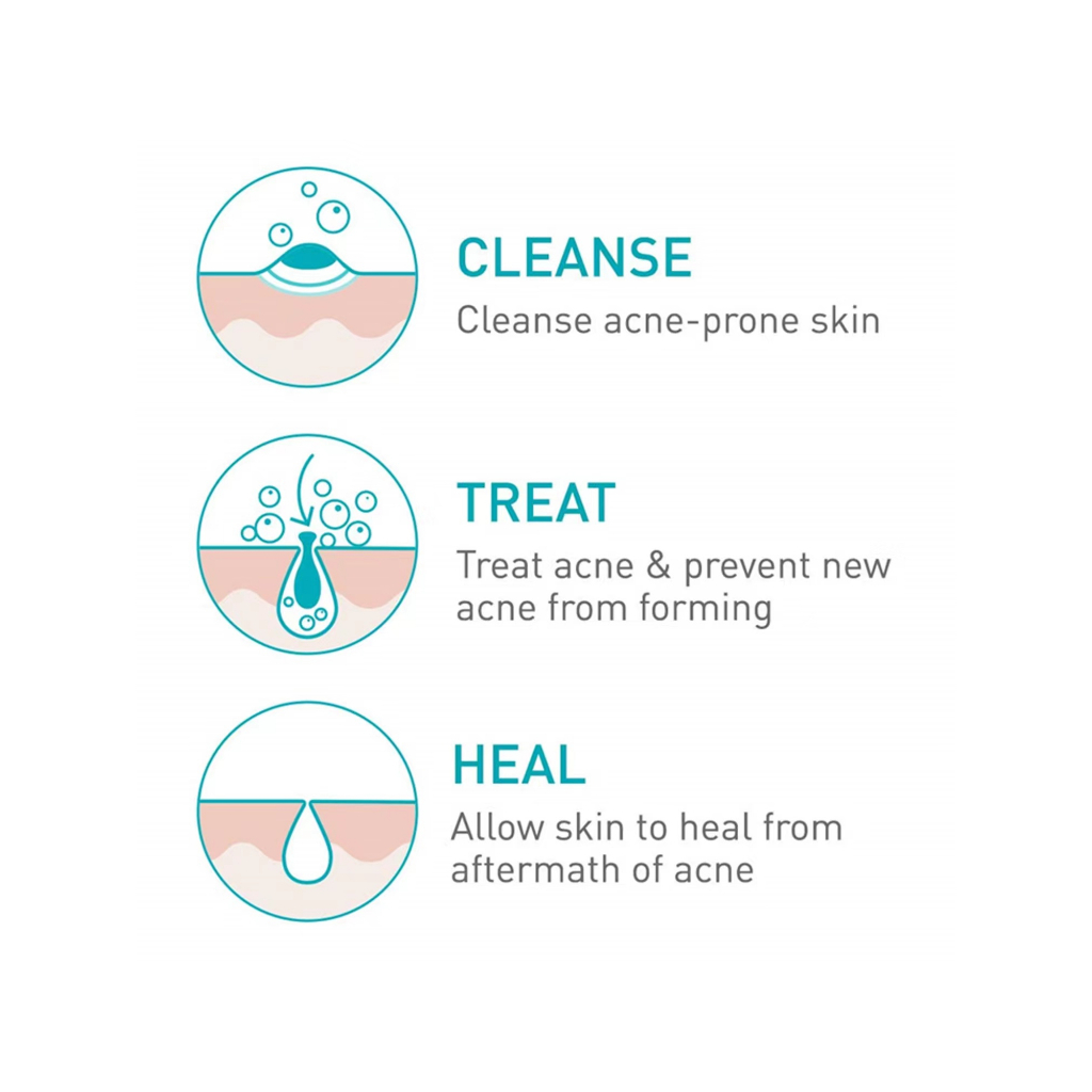 พร้อมส่ง-cerave-acne-foaming-cream-cleanser-benzoyl-peroxide-acne-treatment-150-ml