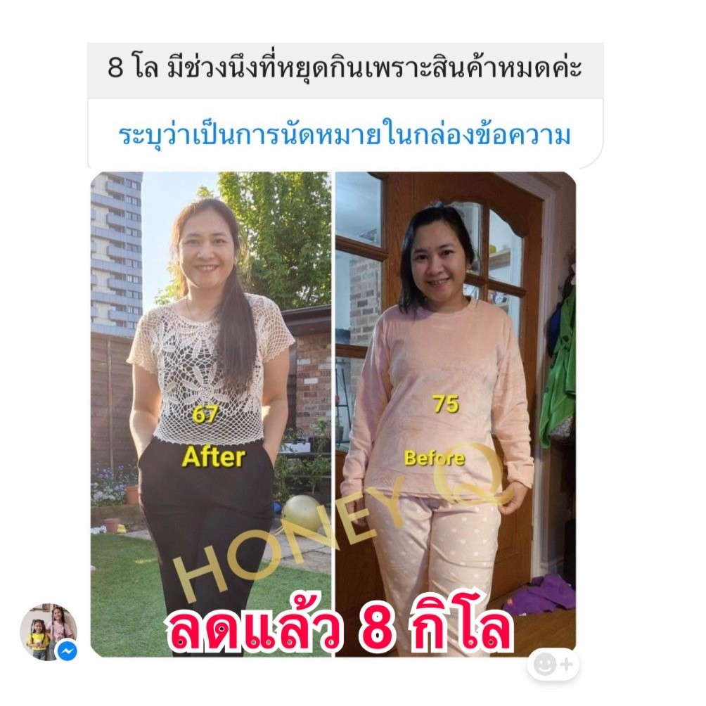 ใหม่-ลดเพิ่ม300-ทักแชท-ฟรี-คอลลาเจน-honey-q-ฮันนี่-คิว-ตัวช่วยหุ่นเฟิร์ม-เร่งเผาผลาญ-บอกลาไขมันส่วนเกิน