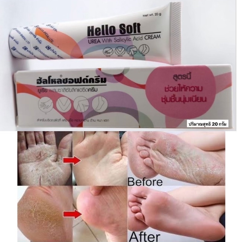 Hello Soft Cream 20 g ฮัลโหลซอฟต์ ครีมบำรุง ให้ความชุ่มชื่น [>หลอดชมพู