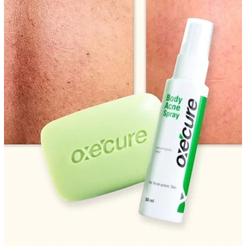 oxecure-body-acne-spray-50-ml-อ๊อกซีเคียว-บอดี้-สเปรย์-สเปรย์ลดสิว-สิวที่หลัง