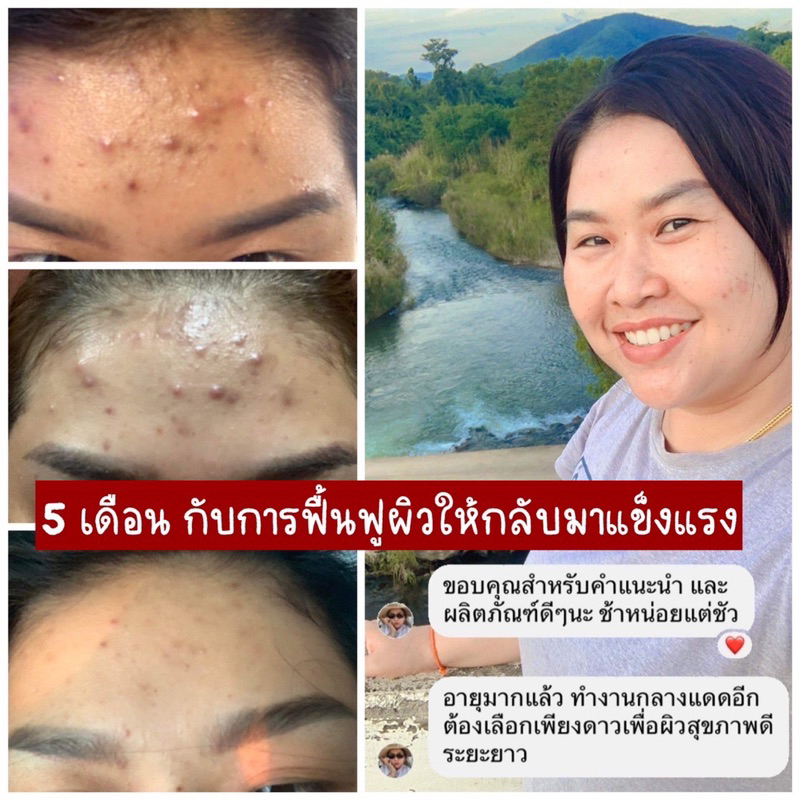 เจลผักสกัดเย็น-เพียงดาว