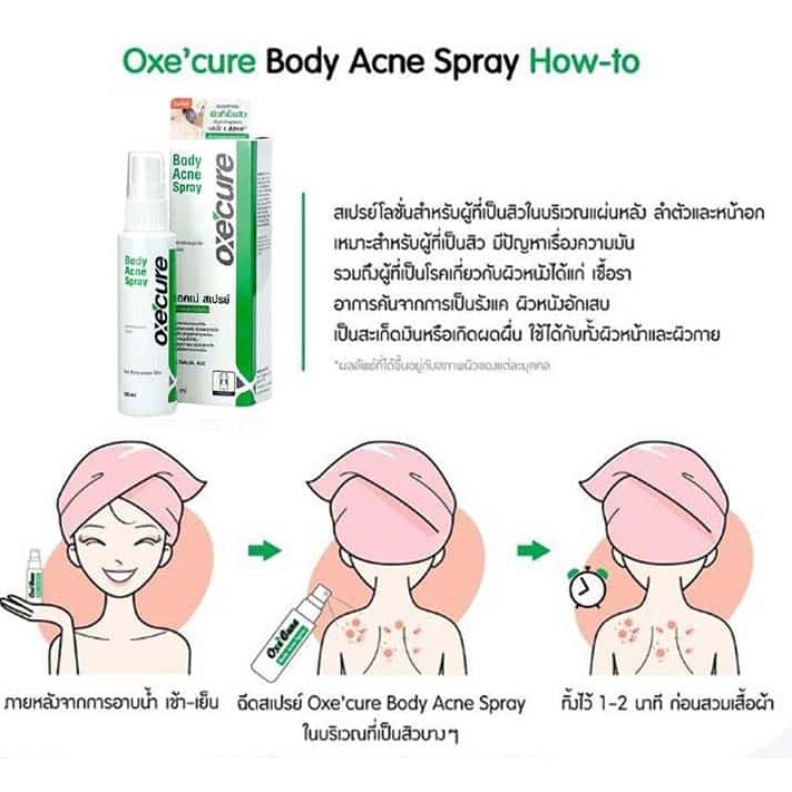 oxecure-body-acne-spray-อ๊อกซี่เคียว-บอดี้-แอคเน่-สเปรย์-25-มล-สำหรับผิวที่เป็นสิว-สเปรย์ลดสิว-1ชิ้น