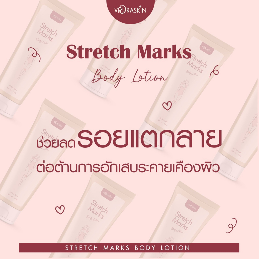 stretch-marks-body-lotion