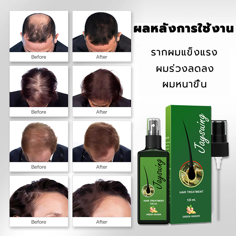 ยาปลูกผมของแท้-เซรั่มปลูกผม-120ml-ป้องกันผมร่วง-บำรุงผม-และบำรุงรากผม-สเปรย์ปลูกผม-น้ำยาปลูกผม-ลดผมร่วง-น้ำยาเร่งผมยาว