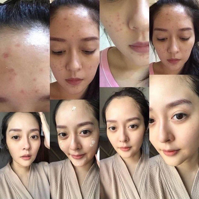 เมอร์รีน่า-ครีมแก้มบุ๋มล็อตผลิตใหม่-merina-ขนาด-4-g