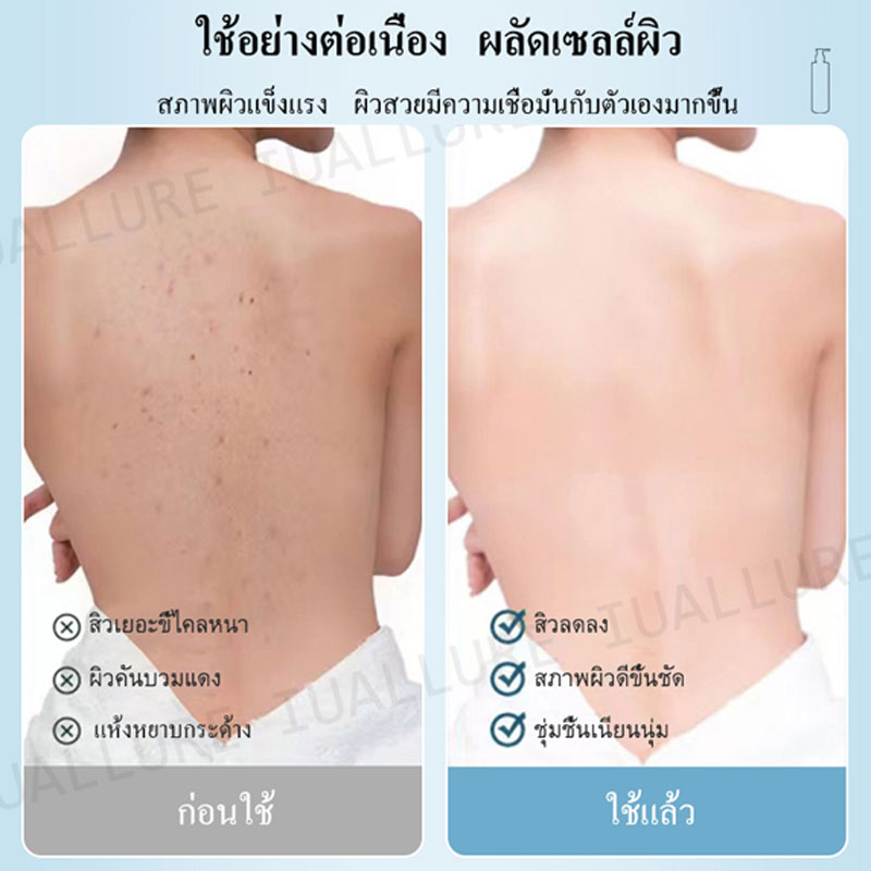 สบู่ลดสิว-ครีมอาบน้ำ-สบู่ไวท์เทนนิ่ง-300ml-ครีมอาบน้ําโฟมเยอะ-รักษาสิว-สบู่ลดสิวที่หลัง-เจลอาบน้ำ-ผิวขาว-ลอกสิวเสี้ยน